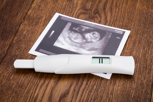 Why You Need an Ultrasound Before You Decide